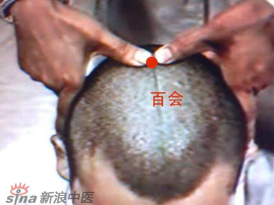 艾灸常用的保健穴有哪些？--百會