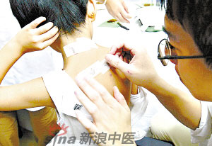 灸法的種類  你知道多少？