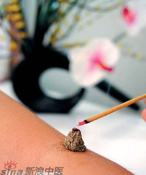 節(jié)氣灸” 冬至，你灸了嗎？