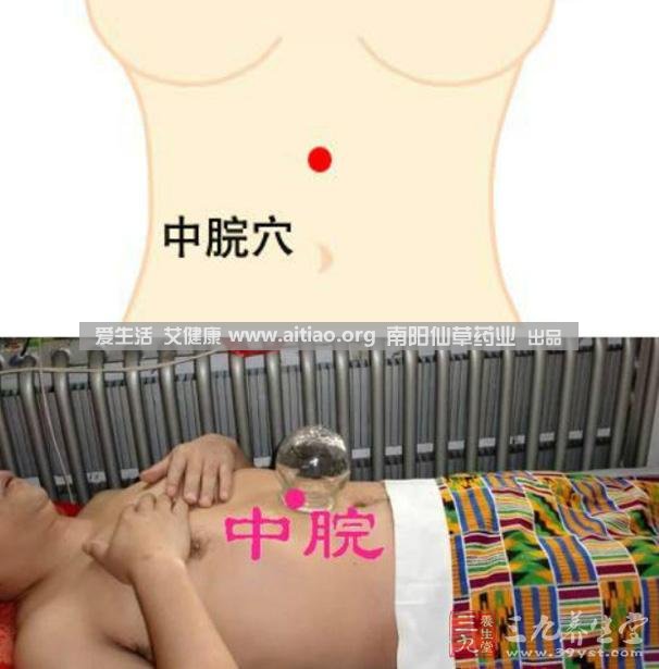 中脘穴位于腹部正中線，臍上4寸的位置上。每天艾灸10-15分鐘，能有效緩解胃部不適的癥狀，同時(shí)有助于祛濕。